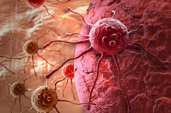 What Is Cancer, Really? A Simple Guide for Nigerian Families